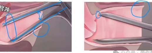 从男性角度、不够客观的聊一聊：妇科“用器”鸭嘴钳_黑料正能量